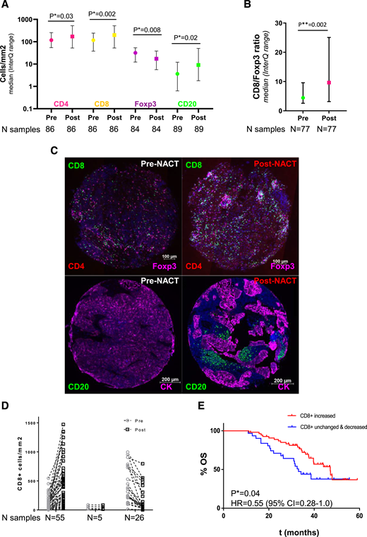 Relative abundance of lymphocytes in pre- and post-NACT paired tumors. A, Median change in CD4+, CD8+, Foxp3+, and CD20+ populations in pre- and post-NACT tumors. Units are expressed in the number of positive cells per mm2 for each marker. B, NACT results in an increased CD8/FOXP3 ratio. C, Representative TMA images of pre- and post-NACT tumors stained for CD8 (green), CD4 (pink), Foxp3 (red), CD20 (green), and CK (pink) markers. Scale bars: 100 and 200 μm. D, Change with NACT in the CD8+ population in individual patients. E, Kaplan–Meier curves show improved OS in CD8+-increased patients post-NACT. A comparison of medians and ratios was performed using the nonparametric Wilcoxon test. A P value of 0.05 was considered significant.