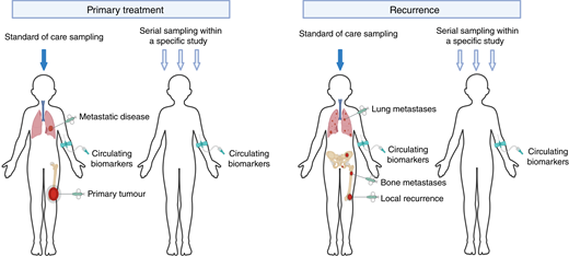 Overview of the sample types to be collected. To maximize the advantages of sample collection, in order to obtain a comprehensive biological understanding of bone sarcoma and host-related factors, different sample types at sequential stages of the clinical pathway should be collected. (Created with BioRender.com.)