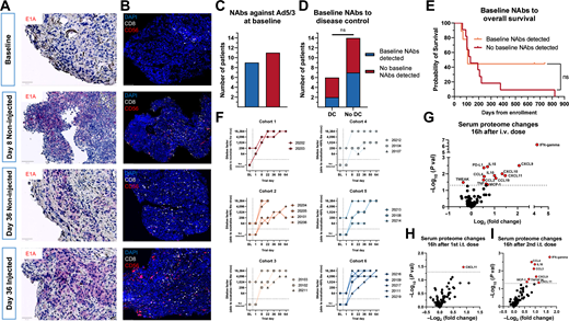 A, Virus staining (violet) in tumor biopsies from patient 20202 at different time points across the trial, showing productive virus replication in injected and noninjected lesions; scale bar, 50 mm. B, Tumor IHC from patient 20202 staining for DAPI, CD8, and CD56 showing increased numbers of effector lymphocytes in injected and non-injected lesions post-treatment; scale bar, 100 μm. C, Neutralizing antibodies (NAbs) against TILT-123 at baseline in all patients. D, Neutralizing antibody presence compared with disease control at day 78. Disease control defined as SMD or better at day 78. No disease control defined as PMD or NA at day 78. Groups compared with the Fisher’s exact test. E, Baseline neutralizing antibody presence compared with overall survival across trial. Groups compared with the MaxCombo log-rank test. F, Neutralizing antibody titer across trial in all dose cohorts. Baseline defined as day 1 pre-treatment value, for days 1 to 64 the highest titer shown for each day (pre-or post-treatment). G, Serum proteomic changes 16 hours after intravenous dosing of TILT-123, pooled patients from cohorts 1 to 5 (n = 15). H, Serum proteomic changes 16 hours after first dose of intratumoral dosing of TILT-123, pooled patients from cohorts 1 to 5 (n = 15). I, Serum proteomic changes 16 hours after second dose of intratumoral dosing of TILT-123, pooled patients from cohorts 1 to 5 (n = 15). For G–I, difference between pre‐and post-treatment protein calculated with the Mann–Whitney U test; ns, non-significant (P > 0.05).