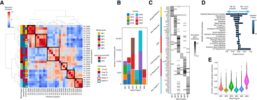 A, Spearman correlation of programs, merged into six MPs. Boxes to the right of the correlation plot were used to indicate, from left to right, the assigned MP of an individual MP, if the individual program belongs to a patient with intimal or UPS sarcoma, and if the individual program belongs to a patient, extracted pre-/post-ICB treatment. In the rightmost column, paired samples from patient X are outlined in red, and paired samples from patient Y are outlined in blue. B, Stack plot showing the contribution of each individual sample to each meta-program. C, Normalized gene contribution to MPs identified using KINOMO. Filtered and selected representative genes (rows) are seen along with their contribution to specific MPs (columns). The most significant GSEA pathway is listed on the right for the set of genes that have the highest normalized contribution for that set of genes. D, Side-by-side comparison of GSEA of the representative genes with a normalized gene contribution highest in either MP3 or MP6, to genes with a normalized gene contribution highest in either MP1, MP2, MP4, or MP5. Combined scores are rescaled to be between 0 and 1. Top of 20 gene sets are visualized. E, Violin plots and boxplots displaying the immune resistance signature expression per cell associated with each MP.