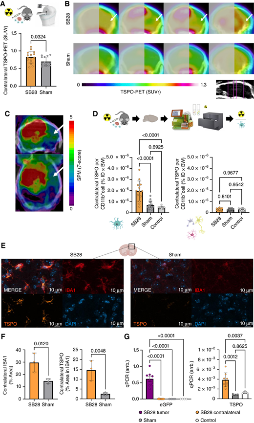 Back-translation into a glioblastoma mouse model pinpoints myeloid cells as the cellular source of contralateral TSPO-PET signal elevations. A, Glioblastoma mice (n = 15) show higher TSPO-PET signal in the contralateral hemisphere compared to sham injected animals (n = 14). B, Coronal slices of group average TSPO-PET images of SB28 glioblastoma mice (top row; n = 15) and sham injected mice (bottom row; n = 14). Analyzed planes are indicated upon a CT template. Arrows point to the PET signal elevation in the contralateral hemisphere of SB28 mice. Tumor hemisphere is blurred. C, Whole brain tumor seed correlation analysis shows dependency of contralateral TSPO-PET signals (white arrows) from tumor TSPO-PET signals in SB28 mice (n = 15). Tumor TSPO-PET signals were extracted using a spherical volume of interest with 1.5 mm diameter and included as a seed in a voxel-wise statistical parametric mapping regression model. D, CD11b positive myeloid cells of the contralateral hemisphere of glioblastoma mice (n = 13) show higher single-cell TSPO tracer uptake than myeloid cells of sham injected (n = 14) or healthy control mice (n = 8; left). Non-myeloid cells show no difference in TSPO tracer uptake between the three conditions (right). E and F, Immunohistochemistry shows higher myeloid cell abundance and increased TSPO in IBA1 positive myeloid cells in contralateral hemispheres of SB28 glioblastoma mice (n = 3) compared to sham (n = 4). G, qPCR was used to exclude infiltration of SB28 glioblastoma cells into the contralateral hemispheres in SB28 glioblastoma mice (n = 8; left). Tumor tissue was used as a positive control. While tumor cells could only be detected in the tumor tissue, TSPO expression was observed in contralateral hemispheres of SB28 glioblastoma mice and exceeded TSPO expression in sham injected (n = 4) and healthy control mice (n = 4, right). (Adapted from an image created with BioRender.com.)