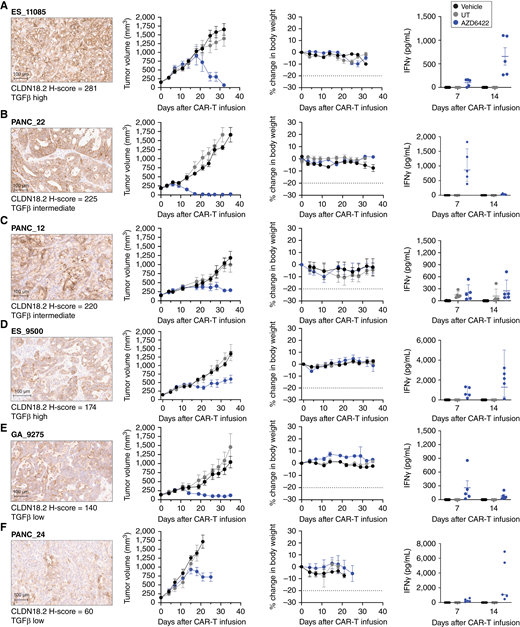 In vivo antitumor activity of AZD6422 in PDX models of gastric cancer, PDAC, and esophageal adenocarcinoma. Activity and tolerability of AZD6422 are shown in various PDX models of esophageal adenocarcinoma (A, ES11085; D, ES_9500), gastric cancer (E, GA_9275), and PDAC (B, PANC_22; C, PANC_12; F, PANC_24). Each model was selected to represent a range of CLDN18.2 (shown at 10× scan) and TGFβ expression. NSG MHC-DKO mice received a single tail-vein infusion of 1e6 AZD6422, donor-matched UT, or vehicle when the average tumor volume reached 150 mm3. Tumor volumes and body weights were measured biweekly until study completion on day 35, and blood was collected for cytokine analysis on days 7 and 14. Data are shown as mean ± SEM (n = 5).