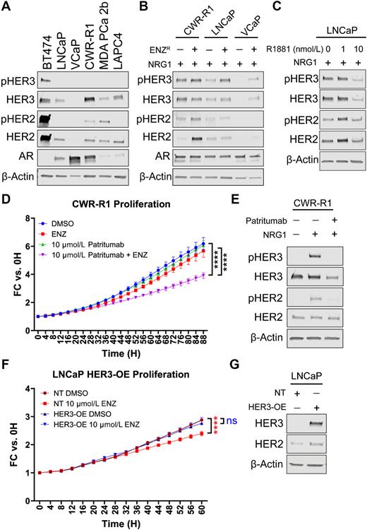Figure 5. HER3 promotes ENZ resistance in prostate cancer models. A, Protein expression of phospho-HER3 (pHER3), HER3, phospho-HER2 (pHER2), HER2, AR, and beta-actin was assessed in an array of prostate cancer cell lines (LNCaP, VCaP, CWR-R1, MDA PCa 2b, LAPC4). BT474 (breast cancer) was used as a positive control for HER2/3 expression and beta-actin was used as a loading control. B, Protein expression of pHER3, HER3, pHER2, HER2, AR) was assessed in ENZ-resistant (ENZR) CWR-R1, LNCaP, and VCaP cells. ENZR cells were maintained in 10 μmol/L ENZ and all cells were treated with 100 ng/mL NRG1 for 15 minutes prior to protein collection. Beta-actin was used as a loading control. C, LNCaP were maintained in 0, 1, or 10 nmol/L R1881 for 6 months to create an androgen-adapted cell line. Cells were treated with 100 ng/mL NRG1 for 15 minutes prior to protein collection. pHER3 and HER3 were decreased in the high androgen condition (10 nmol/L R1881) compared with control (0 nmol/L R1881). pHER2 and HER2 were increased in low androgen (1 nmol/L R1881), but not different in the 10 nmol/L condition versus control. Beta-actin was used as a loading control. D, Cell proliferation was assessed in CWR-R1 cells after treatment with HER3 inhibitor patritumab in combination with ENZ. ENZ alone did not decrease proliferation, but when co-treated with patritumab, cell proliferation decreased significantly compared with either treatment alone (n = 5). E, Western blots confirmed reduction of pHER3 with patritumab (10 μmol/L for 2 hours) after NRG1 stimulation (100 ng/mL for 15 minutes). pHER2 was also decreased after patritumab treatment, but to a lesser degree. Beta-actin was used as a loading control. F, A representative cell proliferation curve in LNCaP HER3 overexpression (HER3-OE) versus non-targeted control (NT) vectors after treatment with 10 μmol/L ENZ. Proliferation decreased in the NT control cells after treatment with 10 μmol/L ENZ; however, the HER3-OE cells did not decrease after treatment with ENZ, suggesting HER3-OE is sufficient for ENZ resistance (n = 3). G, Western blots confirmed OE of HER3 compared with NT control. A two-way ANOVA with Tukey multiple comparison test was used for statistics; ****, P < 0.0001; ns, not significant.