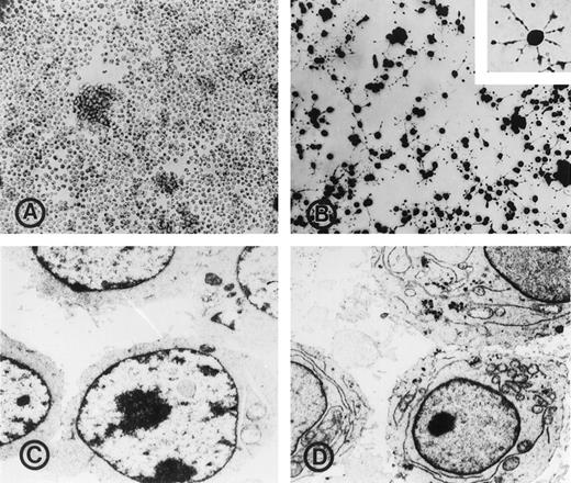 Fig. 3. Morphological changes in PB-treated Namalwa cells. Cells were plated at 105 cell/ml in 100-mm tissue culture dishes precoated with human fibronectin and maintained in the absence (A and C) or presence (B and D) of 2 mm PB for 9 days. A, phase microscopy of untreated cells grown as a suspension culture. B, phase microscopy of PB-treated cultures composed of adherent cells with long processes (stained with Giemsa; ×40). The inset shows a single cell viewed under larger magnification (×200). C, electron micrographs of untreated cells. D, electron micrographs of PB-treated Namalwa cells. Note the increased ratio between cytoplasm and nucleus after treatment, as well as the abundance of endoplasmic reticulum indicative of a more differentiated phenotype.