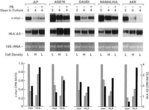 Fig. 4. Changes in cellular myc and HLA expression in cells exposed to PB. BL cells were plated at 105 cell/ml and incubated in the absence or presence of 2 mm PB. Cytoplasmic RNA was prepared from untreated cells on day 2 (▨) and day 4 () and from PB-treated cells on day 4 (▪) of treatment. RNA samples (10 μg) were analyzed on formaldehyde-agarose gels (EtBr-stained 18S rRNA bands indicate the relative amounts of total RNA loaded in each lane) and blotted on nitrocellulose membranes that were consecutively hybridized with 32P-labeled probes for c-myc, HLA A3 (class I), and μ heavy chain (data for μ is not shown). The specific signals were detected by autoradiography on XAR-5 films and by phosphoimaging. The bars represent relative ratios derived from the phosphoimager readings after an 11-h exposure. For each cell line, value 1 was arbitrarily assigned to the untreated culture on day 2. On day 4, the low cell density (L) in PB-treated cultures was 0.5, 0.54, 0.52, and 0.73 × 106 cell/ml for the BL lines JLP, AG876, Daudi, and Namalwa, respectively, and 96 × 104 for the LCL AKR. On that day, the high cell density (H) for the same lines was 2.45, 2.0, 1.63, 2.47, and 2.38 × 106 cell/ml, respectively. The number of untreated cells on day 2 was about 0.5 × 106 cell/ml (L). The number of live cells was determined by trypan blue exclusion of duplicate samples.