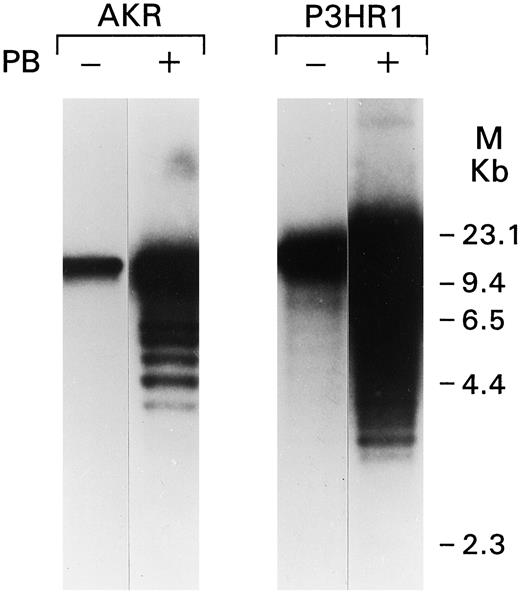 Fig. 5. Induction of EBV DNA replication by PB. DNA was extracted from P3HR1 and AKR cells exposed for 3 days to 2 mm PB and from untreated controls. DNA samples (10 μg/lane) were subjected to Southern blot analysis, as described in “Materials and Methods.” Note the abandence of new EBV DNA copies in treated cells.