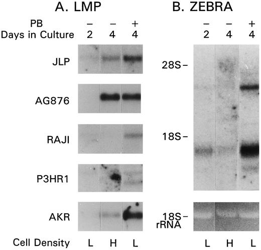 Fig. 6. Up-regulation by PB of EBV gene expression. RNA blots previously hybridized with c-myc, HLA A3 (see Fig. 4<$REFLINK>), and μ heavy chain were stripped and rehybridized with EBV-specific probes. A, LMP expression in indicated cell lines. B, Zebra transcripts in P3HR1. On day 4, the number of P3HR1 and Raji cells was 2.73 × 106 and 2.62 × 106 in untreated cultures (H) and 0.55 × 104 and 0.95 × 104 in PB-treated cultures (L), respectively. The density of other cultures is indicated in the legend to Fig. 4<$REFLINK>.