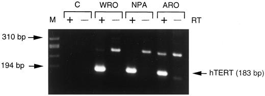 Fig. 2. hTERT gene expression in human thyroid carcinoma cell lines WRO, NPA, and ARO. RNA (200 ng) was used. Bands seen at 270 bp were nonspecific PCR products