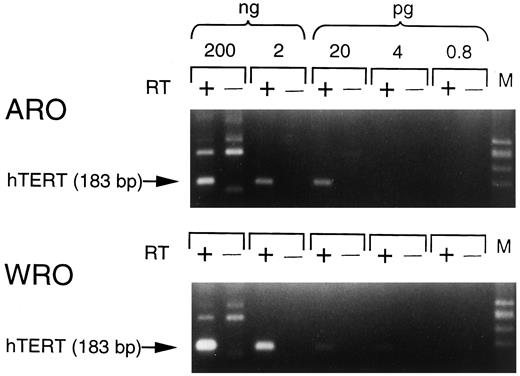 Fig. 3. hTERT gene expression in ARO and WRO cells. Serial dilutions of total RNA from both cells were used as a template in PCR assay. The RNA content is indicated on the top, and molecular size marker (M) is ΦX174-HaeIII digest