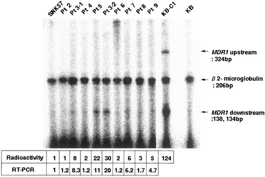 Fig. 2. RNase protection assay of patients with bladder cancer. Arrows, the size of protected products. Below the panel, radioactivity levels corresponding to the 130/134-bp bands and mRNA levels obtained using semiquantitative RT-PCR analysis. Pt 3–1 and Pt 3–2,patient 3 at the recurrence and residual states.