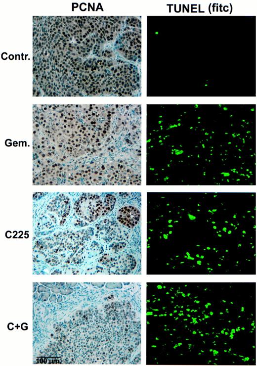 Fig. 4. PCNA and TUNEL immunohistochemistry of L3.6pl human pancreatic tumors growing in nude mice after 18 days of therapy. Tissue sections were analyzed for expression of PCNA (to show cell division) and TUNEL (to show apoptosis). Decreased immunoreactivity to PCNA is observed in tumors from C225 and C225 plus gemcitabine (Gem.) compared with gemcitabine-treated and control (Contr.) animals. Increased DNA fragmentation(apoptosis) identified by localized green fluorescence was observed in specimens from each treatment group compared with controls.