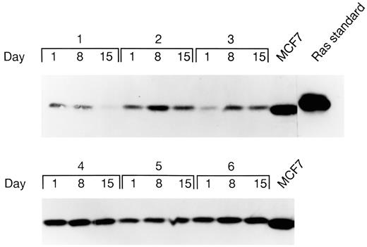 Fig. 6. Proteins obtained from patient PBMC lysates and separated by 12% SDS-PAGE followed by Western blot using anti-pan-ras antibodies. Ras standard and MCF-7 cell proteins serve as positive controls for the unprocessed and processed forms of p21ras. Samples from day 1 (pretreatment) and days 8 and 15 of treatment are shown for six patients treated with POH at the 2800 mg/m2dose level. Decreased p21ras signal is seen on day 15 for patient 1. Increased signal is seen for patients 2, 3, 5, and 6.