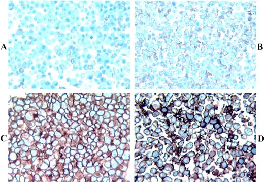 Expression of Her-2/neu in Human Lung Cancer Cell Lines by ...