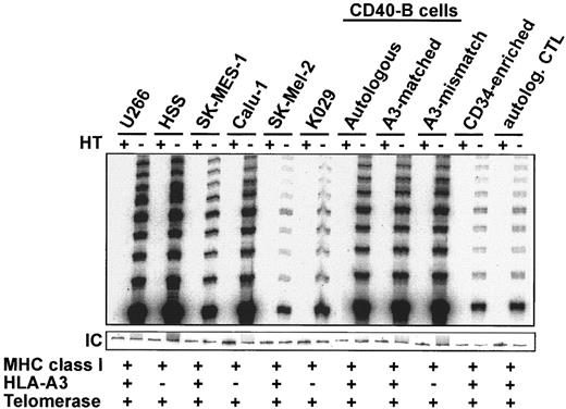 Fig. 2. Telomerase activity of tumor cells and normal cells tested as CTL targets. Cytosolic cellular extracts were assayed for telomerase activity. A 36-bp internal control PCR product (IC) was seen for each reaction. As a negative control, each extract was heat treated (HT) to inactivate telomerase.