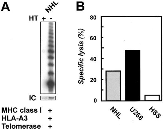 Fig. 4. Cytotoxicity of K973-specific CTLs against primary tumor cells. A, NHL cells obtained after lymph node biopsy of an HLA-A3-positive patient demonstrated telomerase activity. HT, heat treated. B, K973-specific CTLs from one donor tested lysed NHL cells and HLA-A3+ telomerase-positive U266 cells but not HLA-A3-negative, telomerase-positive HSS cells. One representative experiment of two performed is shown at an E:T ratio of 30:1.