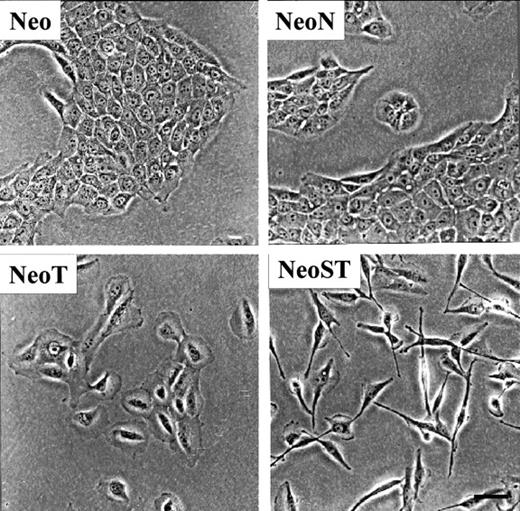 Fig. 1. Morphology of MCF-10A-NeoST cells. MCF-10A cells, grown on coverslips in culture media overnight, were viewed using phase-contrast microscopy. Whereas nontransformed (Neo and NeoN) cells displayed an epithelial morphology, the morphology of Ras-transformed cells (NeoT and NeoST) were more stromal like. Note the spindle-like morphology of NeoST cells and their decreased cell-cell interactions within colonies. Bar = 50 μm.
