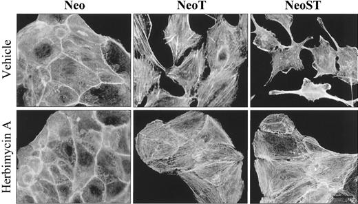 Fig. 4. Elevated tyrosine kinase activity alters the organization of the actin cytoskeleton in transformed MCF-10A cells. Monolayers of the indicated variants of MCF-10A cells were incubated with a vehicle control (top panels) or with the tyrosine kinase inhibitor herbimycin A (875 nm). The actin cytoskeleton was stained with fluorescein-conjugated phalloidin, revealing that transformed cells have more prominent actin stress fibers and lamellipodia. Note that herbimycin-treated cells adopt a more epithelial morphology, with increased actin adhesion belts between cells and decreased lamellipodia. Bar = 25 μm.