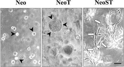 Fig. 5. Differential behavior of NeoST cells suspended in Matrigel. The variants of MCF-10A cells were cultured within a 3dRBM (Matrigel) at 37°C for 7 days. The morphology of cell aggregates was evaluated using phase-contrast microscopy. Note that whereas NeoT cells form larger cell colonies than nontransformed (Neo) cells (denoted by arrowheads), the NeoST cells formed tubular networks (open arrows) that dispersed throughout the Matrigel. Bar = 50 μm.