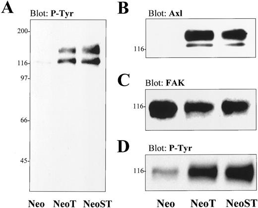 Fig. 6. Increased tyrosine kinase expression transformed MCF-10A cells. Monolayers of MCF-10A cell variants were extracted in radioimmunoprecipitation assay buffer and resolved by SDS-PAGE. The samples were Western blotted with antibodies specific for phosphotyrosine (A) or Axl (B). The protein levels (C) and phosphotyrosine content (D) of immunoprecipitated FAK were assessed by Western blot analysis with specific antibodies.