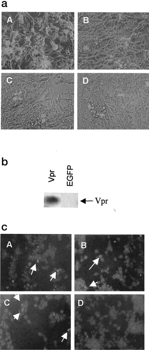 Fig. 1. EGFP- and Vpr-lentiviral vector treatment of AT-84 cells in vitro. a, expression of EGFP in a dose-dependent manner in AT-84 cells determined 72 h after infection with lentiviral vector. AT-84 cells were plated in 24-well plates (20,000 cells/well), and the cells were infected with the EGFP lentiviral vector at an MOI of 20 (A), 10(B), 3 (C), or 1 (D). Three days after the infection, the expression of EGFP was observed by UV microscopy. b, expression of Vpr in AT-84 cells. AT-84 cells plated in 24-well dishes were grown and infected with the Vpr or EGFP lentiviral vector at the MOI of 10. Three days after the infection, cells were lysed in 20 μl SDS-PAGE loading buffer. After denatured in 100°C for 5 min, sample was loaded on 15% gel. Then protein was blotted to nitrocellulose membrane and detected by anti-HA antibody. c, apoptosis of AT-84 cells by the Vpr lentiviral vector. AT-84 cells plated in 24-well dishes (20,000 cells/well) were infected with the Vpr lentiviral vector at the MOI of 10 (A), 2 (B), 0.4 (C), or 0 (D). The apoptotic cells were detected by TUNEL. Arrows, apoptotic cells.
