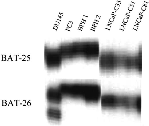 Fig. 3. PCR amplification of C33, C51, and C81 stage cells including PC3, DU145, and BPH with mononucleotide repeats (BAT-25 and BAT-26). The PCR products were analyzed on a denatured 6% polyacrylamide gel. Note a higher mobility of LNCaP cells and DU145 compared with BPH and PC3 suggesting the mutator phenotype in LNCaP-C33 stage cells.