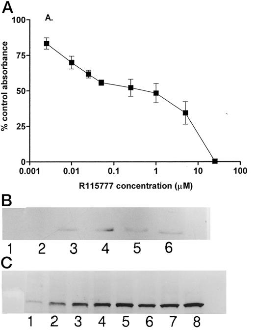 Fig. 1. In vitro effects of R115777 against MCF-7 human breast cancer cells. A, growth inhibition after 4 days of exposure and assessment of cell number by the SRB assay. Values are mean ± SD (bars); n = 3. B, induction of prelamin A as determined by Western blotting of MCF-7 cells exposed to different concentrations of R115777 for 24 h. Lane 1, 0.2 μm; Lane 2, 0.4 μm; Lane 3, 1.0 μm; Lane 4, 2.0 μm; Lane 5, 4.0 μm; Lane 6, 10 μm. C, induction kinetics for prelamin A following exposure of MCF-7 cells to 2 μm R115777. Lane 1, 1 h; Lane 2, 2 h; Lane 3, 4 h; Lane 4, 8 h; Lane 5, 16 h; Lane 6, 24 h; Lane 7, 48 h; Lane 8, 72 h.