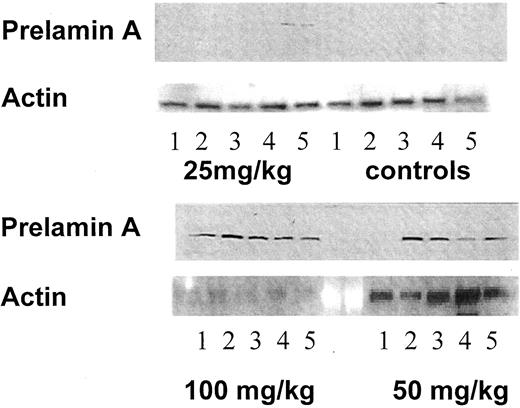 Fig. 3. Increases in prelamin A as determined by Western blotting of MCF-7 xenografts taken at day 11, one day after the final dose of either vehicle (controls) or R115777 administered p.o. twice daily for 10 consecutive days at dose of 25, 50, and 100 mg/kg. Lanes 1–5 for each group refer to individual tumors/animals. Levels of actin are shown as loading controls.