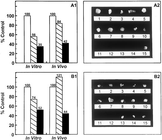 Fig. 1. Ex vivo transfection of prostate tumor cells inhibits angiogenin secretion in vitro and subsequent tumorigenicity in mice. PC-3 (A1) or PC-3M (B1) cells were treated with either Lipofectin alone or Lipofectin together with 1 μm of antisense JF2S or sense control JF1S as described in “Material and Methods.” The results for sense JF1S- (▧) or antisense JF2S- (▪) transfected cells are presented relative to those of Lipofectin-treated cells (100%; □). A1 and B1, In Vitro, the amount of angiogenin secreted by [S]ODN-transfected PC-3 (A1) and PC-3M (B1) cells was determined by ELISA and normalized to cell number; the SE of triplicate determinations of these amounts for Lipofectin-, JF1S-, and JF2S-transfected cells was 9, 10, and 7%, respectively, for PC-3 cells and 10, 5, and 2%, respectively, for PC-3M cells. A1 and B1, In Vivo, the above transiently transfected cells were subsequently injected s.c. into athymic mice (five mice per treatment group). The average weight of PC-3 and PC-3M tumors that appeared after injection of these ex vivo-transfected cells are shown [A1 (PC-3): n = 5 for Lipofectin and JF1S treatment groups, n = 1 for the JF2S treatment group; and B1 (PC-3M): n = 5 for Lipofectin and JF1S treatment groups, n = 3 for the JF2S treatment group]. The SEs of the weights of the PC-3 tumors in the Lipofectin and JF1S groups were 23 and 26%, respectively; only one tumor arose in the JF2S group. The SEs for the weights of the PC-3M tumors were 20, 12, and 12% in the Lipofectin, JF1S, and JF2S groups, respectively. A2 and B2, photographs of excised PC-3 (A2) and PC-3M (B2) tumors of which the average weights are reported in A1 and B1 (In Vivo). Tumors resulting from injection of cells treated ex vivo with Lipofectin (top row), Lipofectin plus either sense JF1S (middle row), or antisense JF2S (bottom row) are shown.