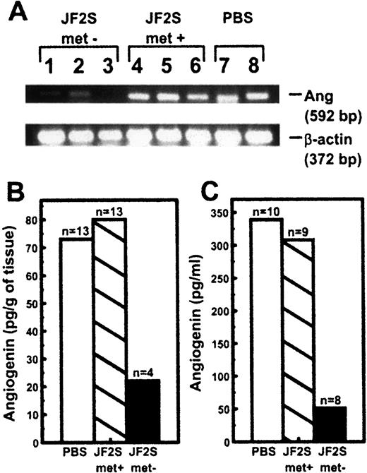 Fig. 4. Reduction of human angiogenin mRNA and protein levels in vivo by antisense JF2S. Orthotopically growing primary PC-3M tumors and serum were taken at sacrifice (days 39–40) from mice treated beginning on day 0 with either PBS or JF2S as described in Fig. 3<$REFLINK>. Total RNA and protein were extracted from tumors as described in “Materials and Methods.” A, expression of human angiogenin mRNA as detected by RT-PCR in primary tumors from mice treated with JF2S in which mice were free of metastases (Lanes 1–3); treated with JF2S in mice where metastases arose (Lanes 4–6); or treated with PBS (Lanes 7 and 8). Lower panel contains corresponding PCR products for β-actin indicating integrity of total RNA. B and C, ELISA determinations (performed in duplicate) of the amount of human angiogenin protein extracted from primary tumors (B) or present in mouse serum (C). □, mice treated with PBS; ▧, mice treated with JF2S in which metastasis arose; ▪, mice treated with JF2S in which metastasis was prevented.