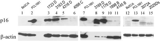 Fig. 2. Expression of p16 protein in primary neuroblastoma. Protein expression of p16 in neuroblastoma was determined with Western blot analysis. All of the levels of protein expression are in comparison with that of β-actin. Lanes 1 and 12, p16-deleted Be2c/ADR5 neuroblastoma cell line shown as a negative control (8, 33); Lanes 2, 7, and 13, pronounced p16 expression in the PCL1691 neuroblastoma cell line shown as a positive control (33); Lanes 3–6, 8, and 9, primary neuroblastoma samples that expressed p16 mRNA; and Lanes 10, 11, 14, and 15, samples that expressed no or barely detectable level of p16 mRNA.