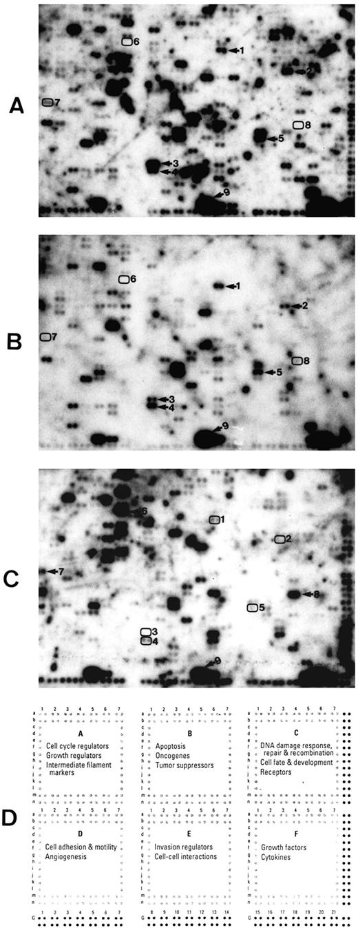 Fig. 1. A–C, global gene expression profiles of cancer-related genes of two human ESCC cell lines HKESC-1 (A) and HKESC-2 (B) and one corresponding morphologically normal esophageal epithelium (C) from the patient of which the HKESC-2 was derived using Atlas Human Cancer cDNA Expression Arrays. Some of the differentially expressed genes are indicated: 1, MET (B6h); 2, Jagged 2 (C3k); 3, MMP13 (E1j); 4, MMP14 (E1k); 5, BIGH3 (F1f); 6, CK4 (A7g); 7, CSPCP (D1a); 8, IL-1RA (F4d); and 9, GAPDH (G12). D, schematic diagram of Atlas Human Cancer cDNA Expression Arrays. The arrays contain 588 human genes spotted in duplicate and divided into six functional categories (quadrants A–F). Three blank (G1, G8, and G15) and nine negative (G2–4, G9–11, and G16–18) controls are included to confirm hybridization specificity. Nine housekeeping genes (G5–7, G12–14, and G19–21) are also included in the arrays for normalizing mRNA abundance. Genomic DNA spots (dark dots) serve as orientation marks to facilitate in the determination of the coordinates of hybridization signals. A complete gene list with arrays coordinates and GenBank accession numbers is available at the website.4
