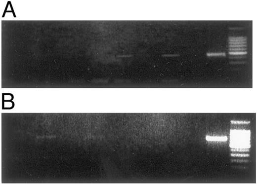 Fig. 2. TrkA and p75 mRNA expression in effusions as detected using RT-PCR. A, TrkA mRNA expression is evident in two effusions. B, mRNA expression of p75 in two specimens. Positive control (the lane nearest to the DNA ladder) consists of the PC-12 rat pheochromocytoma cell line in both figures.