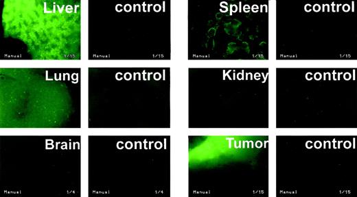 Fig. 1. Systemic dissemination of adenovirus after intratumoral injection. Expression of GFP in tumor and organs of tumor-bearing C57BL/6 mice after intratumoral injection of adenovirus constitutively encoding GFP (AdGFP) as compared with noninjected control animals (×20).