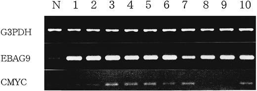 Fig. 3. EBAG9 gene and CMYC gene expression in the cell lines by RT-PCR. N, normal breast; Lanes 1–10, breast cancer cell lines (Lane 1, MDA-MB-453; Lane 2, CRL1500; Lane 3, YMB-1-E; Lane 4, MCF7; Lane 5, HBL100; Lane 6, OCUB-M; Lane 7, BT-20; Lane 8, BT-474; Lane 9, MDA-MB-435S; Lane 10, SK-BR-3).