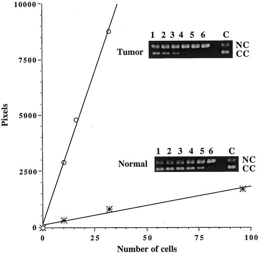 Fig. 1. Illustrative assay of Ap endo activity in extracts of a glioblastoma and adjacent histologically normal brain. Covalently closed, supercoiled pKT100 plasmid DNA containing ∼1.5 abasic sites/molecule was incubated with increasing amounts of extract for 15 min at 37°C. Reaction products were resolved by agarose gel electrophoresis (insets). Incision at abasic sites was monitored by conversion of substrate DNA (lower band; CC, covalently closed) to relaxed molecules that migrate more slowly (upper band; NC, nicked circular). Lanes 1–6 in the insets contain extract equivalent to 10, 16, 32, 96, 288, and 865 tumor cells, and 10, 32, 96, 290, 871, and 2613 cells from adjacent normal brain; the density of the product band in the no extract control (C) was subtracted to yield the pixel values. The lines shown were derived by regression analysis of data illustrated in the insets; the points shown lie on the initial portion of the curves, and establish linearity of the assay with added extract.