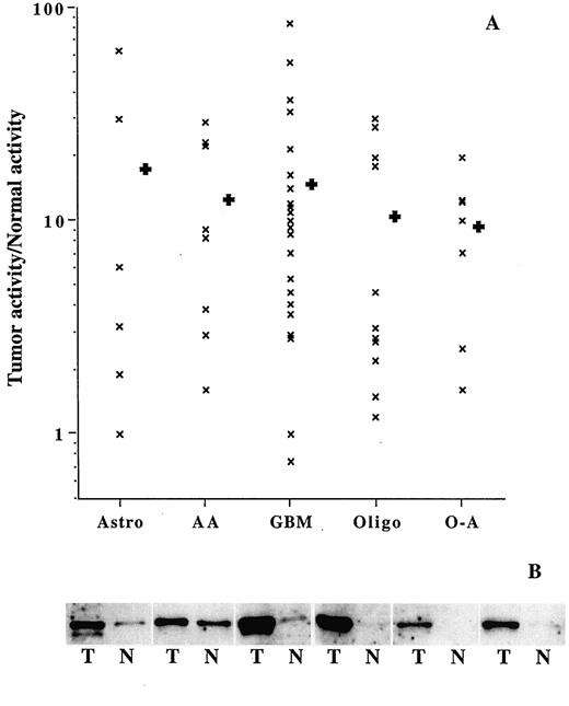 Fig. 4. Ratio of Ap endo activities in paired gliomas and adjacent normal brain. A, elevation of activity, (logarithmic scale; range, 1.2- to 85-fold) in 54 of 58 tumor-normal pairs. Heavy crosses indicate mean increases within diagnostic groups, which ranged from ∼9- to 17-fold. Astrocytoma (Astro), anaplastic astrocytoma (AA); glioblastoma multiforme (GBM); oligodendroglioma (oligo); mixed oligo-astrocytoma (O-A). B, concomitant elevation of Ape1 protein, detected by Western blotting of extract equivalent to 2 × 105 cells, for 6 tumor-normal pairs.