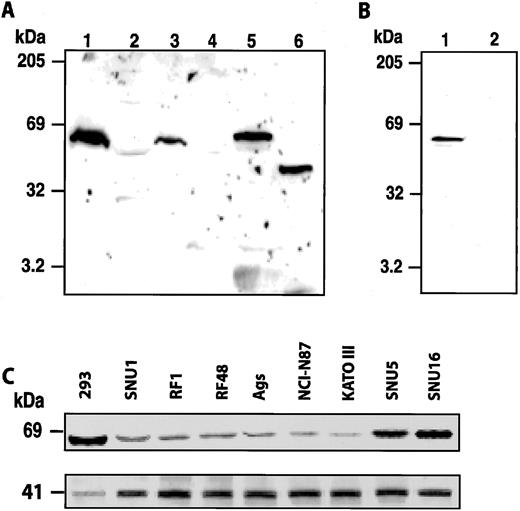 Fig. 1. Immunoblot analysis of Fez1 protein. A, Western blot analysis of Fez1 protein using antipeptide rabbit serum. One hundred μg (Lanes 1 and 2) and 50 μg (Lanes 3 and 4) of proteins from normal human brain (Lanes 1 and 3) and normal human testis (Lanes 2 and 4) were loaded. In vitro translated full-length Fez1 protein (Lane 5) and in vitro translated truncated Fez1 protein lacking the COOH-terminal portion (Lane 6) were also loaded. B, immunoprecipitation using anti-Fez1 antibody. Fez1-negative HeLaS3 cells were transfected with the FEZ1 cDNA. After immunoprecipitation with anti-Fez1 antibody (Lane 1) or with the preimmune normal rabbit serum (Lane 2), the HeLaS3 cell lysate was blotted and probed with the anti-V5 tag antibody. C, Western blot analysis of Fez1 expression. Upper panel, Fez1 protein expression in gastric carcinoma derived cell lines (Lanes 2–9), compared with 293 cells (Lane 1). Lower panel, β-actin expression for the same membrane. Left (all panels), molecular weight in thousands.
