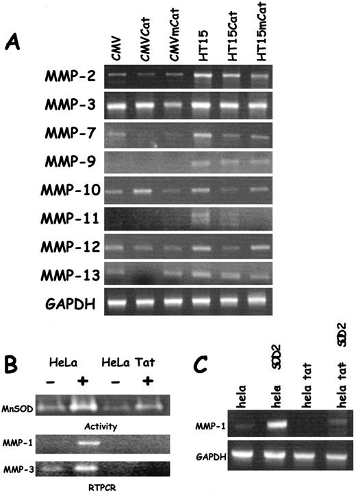 Fig. 3. Redox-dependent expression of inducible MMPs. A, RT-PCR analysis of MMP levels from CMV, CMVCAT, CMVmCAT, HT15, HT15CAT, and HT15mCAT. See “Materials and Methods” for details. B, analysis of Sod2, MMP-1, and MMP-3 from HeLa and HeLa Tat cells. Top panel, nondenaturing Sod PAGE of HeLa and HeLa Tat cell extracts before and after overnight treatment with TNF (10 ng/ml) treatment. Ten μg of total cell protein were loaded per lane. Lower panel, RT-PCR analysis of MMP-1 and MMP-3 treated as described above. C, Sod2 overexpression reverses the Tat-dependent inhibition of MMP-1 expression in HeLa cells. RT-PCR analysis of MMP-1 and GAPDH HeLa and HeLa Tat transfected with or without Sod2.