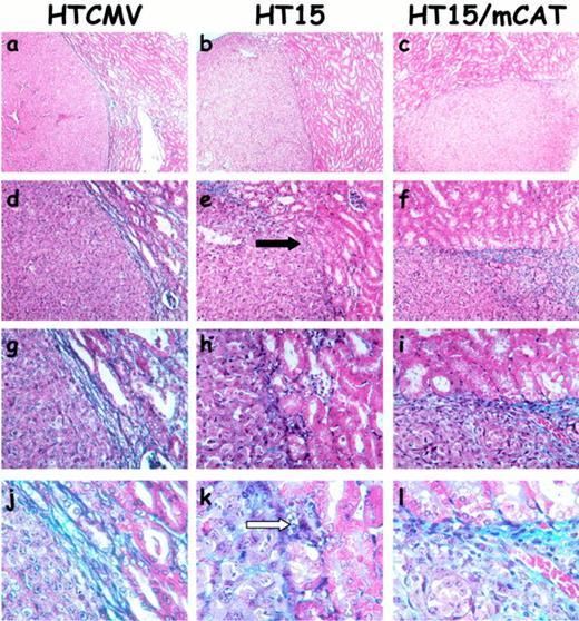 Fig. 5. Masson’s trichrome staining of SRC of control and Sod2-overexpressing cell lines after 2 weeks. a, d, g, and j, HTCMV (control); b, e, h, and k, HT15 (15-fold increase in Sod2); c, f, i, and l, HT15/mCAt (Sod2 and catalase coexpressors). Light blue staining, areas of collagen deposition. Black arrow, area showing regions in which there is a complete loss of collagen. White arrow, regions in which tumor cells are infiltrating the underlying renal parenchyma. From top to bottom, ×4, ×10, ×20, and ×40, respectively. Images are representative of four independent SRC xenotransplantations for each cell type.