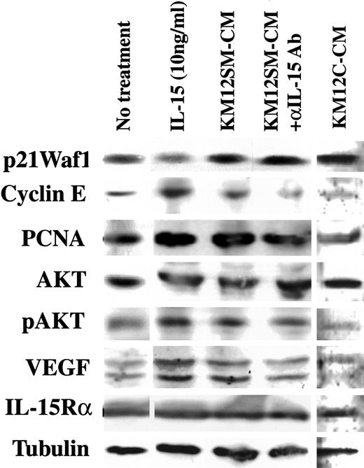 Fig. 5. Effects of IL-15-, KM12SM-, and KM12C-preconditioned media on protein expression in IEC6 cells. The production of p21Waf1, cyclin E, PCNA, total AKT, pAKT, VEGF, and IL-15R α subunit was examined by immunoblotting. Tubulin served as an internal control. Cells were treated with 10 ng/ml human IL-15, concentrated KM12SM-conditioned medium (KM12SM-CM), concentrated KM12SM-conditioned medium pretreated with anti-IL-15 Ab (KM12SM-CM+αIL-15Ab), or concentrated KM12C-conditioned medium (KM12C-CM) for 48 h. Fifty μg of total cell lysate were subjected to 12.5% SDS-PAGE and electroblotted onto nitrocellulose membranes.