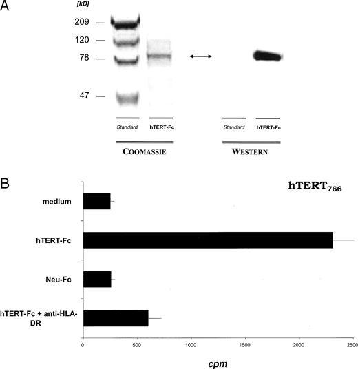 Fig. 5. A, analysis of recombinant hTERT protein. SF9 insect cells cells were infected with hTERT-Fc baculovirus. After lysis of whole cells, the Fc-tagged hTERT protein was purified by protein A affinity chromatography. The purified protein was detecetd on a 10% SDS-PAGE gel by Coomassie Blue staining. A Western blotting using an antibody against hTERT showed a single band of approximately 79 kDa. B, responses of T-cell clone hTERT766 to natively processed hTERT protein. The hTERT766-specific T cells (clone hTERT766 BCM-17.5; 2 × 104 cells/well) were stimulated with irradiated autologous PBMC-derived DCs (1 × 103 DCs/well) pulsed with recombinant hTERT-Fc protein or irrelevant Neu-Fc protein control (10 μg/ml). After 3 days of culture, [3H]thymidine incorporation was determined. The proliferation of T cells cocultured with hTERT-Fc-pulsed DCs was significantly higher than that of T cells with control Neu-Fc protein-pulsed DCs (P < 0.05) and with addition of anti-HLA DR antibody (P < 0.05). Values shown are the mean of triplicate determinations (bars, SD). The representative result of one of three repeated experiments is shown.