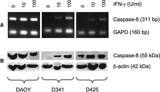 Fig. 3. Treatment with IFN-γ restores caspase-8 mRNA expression (A) and caspase-8 protein expression (B) in human MB cells D341 and D425 (DAOY cells serve as a control). Representative examples of semiquantitative reverse transcription-PCR with GAPD as an internal control (A) and Western blotting with β-actin as an internal control (B).