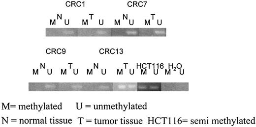 Fig. 2. MSP analysis of the promoter region of p16INK4a. The presence of visible PCR product in lanes U indicates the presence of unmethylated genes of p16INK4a, the presence of product in lanes M indicates the presence of methylated genes. HCT116 DNA, which is semimethylated, was used as positive control for both methylation and unmethylation of p16INK4a. Unmethylated and methylated DNA was used for unmethylated and methylated control DNA. Water controls for PCR reaction are also shown. MSP of p16INK4a in normal and tumors is shown. CRC1, CRC7, and CRC9 are unmethylated at p16INK4a. CRC13 is methylated at p16INK4a.