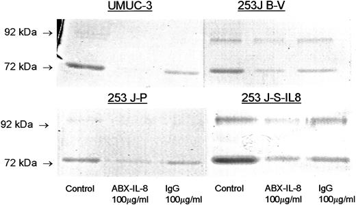 Fig. 2. Collagenase activity of MMP-2 and MMP-9. 253J-P cells, 253J-S-IL8, 253J B-V, and UMUC-3 cells were treated with ABX-IL8 and IgG for 3 days. The conditioned media (without FBS) was collected, and gelatin zymography was performed. This is one representative experiment of three.