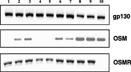 FIGURE 3. RT-PCR analyses: OSM, OSM specific receptor (OSMR), and gp130 in cell lines. RNA was extracted and reverse transcribed (“Materials and Methods”) from the following melanoma cell lines: (1) A375, (2) 136.2, (3) IGR-39D, (4) 453A, (5) MM96L, (6,7) MU, and (8,9) EW. Lane 10 shows the B-cell line RAMOS, as a control. PCR analyses were performed with appropriate primers with standard conditions (“Materials and Methods”).