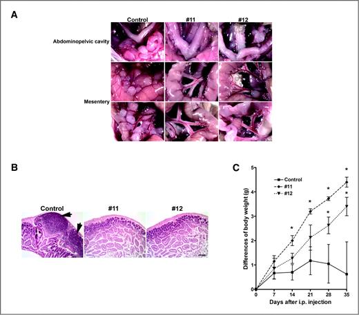 Figure 3. WNT7A knockdown inhibits tumor progression. A, in vivo xenograft tumor progression. Nude mice were injected intraperitoneally (i.p.) with control cells or WNT7A knockdown cells (#11 or #12). The images provide a direct view of the area in abdominopelvic cavity around the reproductive tract and intestinal mesentery. B, histologic examination of intestine following intraperitoneal injection with control and WNT7A knockdown cells. Scale bar = 100 μm. C, differences in body weight are shown during 5 weeks. * versus control, P < 0.05.