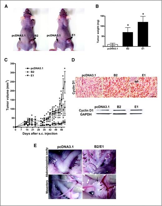Figure 5. WNT7A overexpression increases tumor growth. A and B, in vivo xenograft tumor growth. Nude mice were injected subcutaneously with vector control or WNT7A-overexpressing cells (B2 or E1). Final tumor photographs (A) and tumor weight (B) 9 weeks after subcutaneous injection are shown. * versus pcDNA3.1 vector control, P < 0.05. C, tumor volume was measured every 2 days 10 days after subcutaneous injection. * versus pcDNA3.1 vector control, P < 0.05. D, cyclin D1 expression in subcutaneous tumors that developed from pcDNA3.1 vector control and WNT7A overexpressed cells was determined by immunohistochemistry and Western blot analyses. Scale bar represents 100 μm. E, in vivo xenograft tumor progression. Nude mice were injected intraperitoneally with vector control cells or WNT7A-overexpressing cells (B2 or E1). The images provide a direct view of the area in abdominopelvic cavity around the reproductive tract and intestinal mesentery.