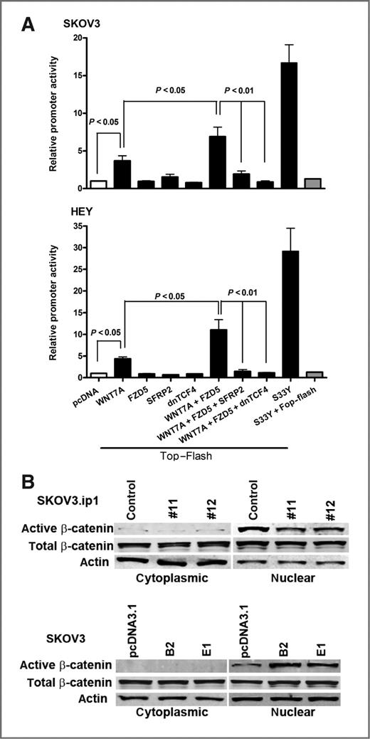 Figure 6. WNT7A activates the β-catenin/TCF/LEF signaling pathway in ovarian cancer cells. A, to measure WNT/β-catenin signaling in SKOV3 and HEY cells lacking endogenous WNT7A, cells were cotransfected with either empty pcDNA3.1 or one or more of the indicated WNT7A, FZD5, SFRP2, dnTCF4, or S33Y expression vectors in concert with the firefly luciferase-tagged Top-Flash reporter or Fop-Flash as a negative control. Luciferase activity was measured by a Dual-Luciferase Reporter Assay System 24 hours after transfection. The results are presented as the mean relative light units per sec (RLU/sec) derived from 3 independent experiments. Data were arbitrarily set to background level of 1 from luciferase activity transfected with pcDNA3.1 vector. B, nuclear or cytoplasmic β-catenin in SKOV3.ip1 control or WNT7A knockdown cells, or SKOV3 control or WNT7A-overexpressing cells as determined by Western blot analysis.