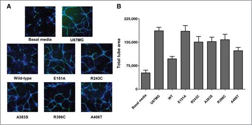 Figure 4. CCK2R variants increase cord formation in a tumor-driven cord formation assay. A, HEK293 CCK2R stable clones were grown in the presence of a coculture of ADSCs and ECFCs for 96 hours. Cells were then processed and stained for CD31 endothelial stain (green) and Hoechst nuclear stain (blue) as described in Materials and Methods. Images of representative wells were acquired on an ArrayScan VTI. U87MG cells secrete high levels of VEGF and were used as a positive control in the assay for VEGF-promoted cord formation (23). B, quantitation of total tube area; n = 3 wells per condition. WT, wild-type.