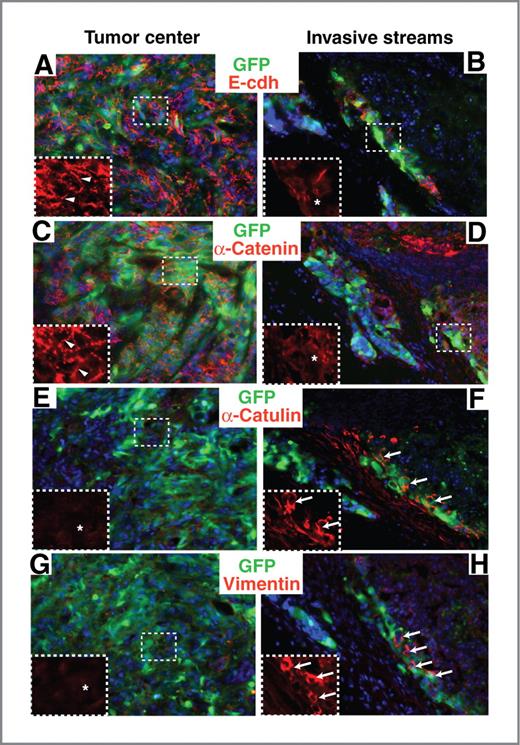Figure 2. Loss of cell–cell adhesion in invasive tumor cells correlate with the upregulation of α-catulin. Tumors formed from the injection of GFP-labeled hSCC cells were analyzed for cell–cell adhesion markers (A–D), α-catulin (E–F), and the mesenchymal marker, vimentin (G–H) by immunofluorescence. Left, sections from the center of the solid primary tumor; right, sections of invasive streams of tumor cells. Representative images are shown, with selected regions magnified as marked. Arrowheads point out the presence of cell–cell adhesion markers at the cell junctions in the tumor center (A and C); asterisks show the lack of cell–cell adhesion markers on the cell membrane in the invasive streams of tumor cells (B and D) or the lack of α-catulin (E) and vimentin (G) in the tumor center; arrows show the migrating, invasive tumor cells that are expressing α-catulin (F) or vimentin (H).